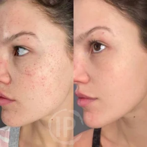 بلک ماسک استوینت Ostwint با خاصیت Peel Off حجم 150ml