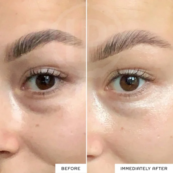 قبل و بعد استفاده از کرم دور چشم سیمپل مدل Revitalising